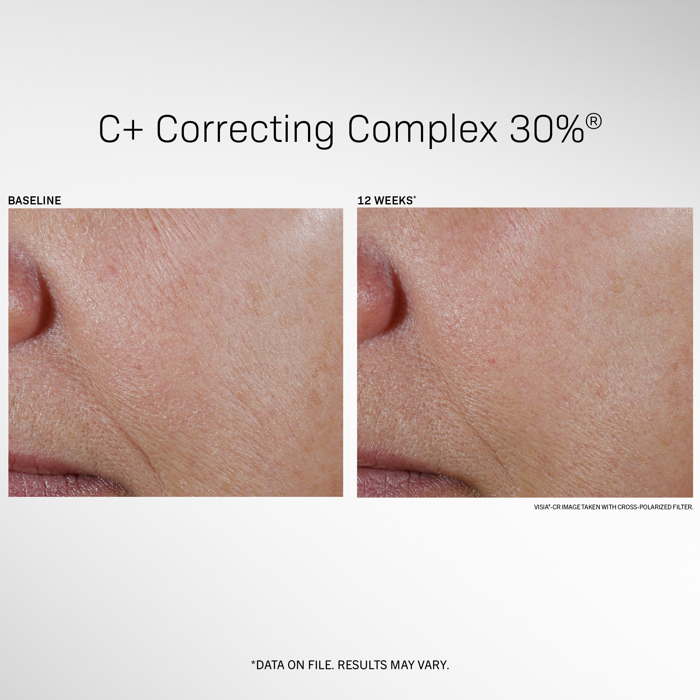 C+ Correcting Complex 30%®